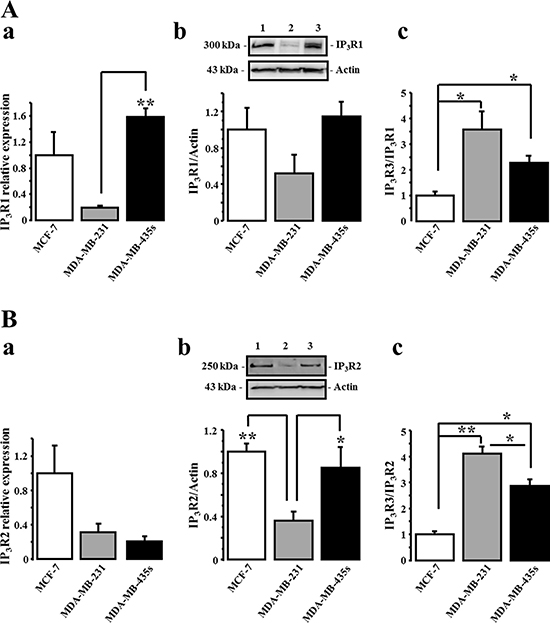 The expression level of IP3R1 and IP3R2 is independent of breast cancer migration capacity.