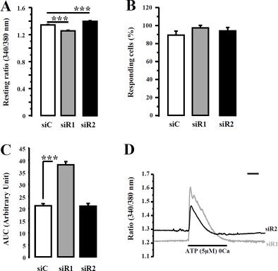 IP3R1 or IP3R2 silencing has no impact on ATP-induced Ca2+ profile in MDA-MB-435S cells.