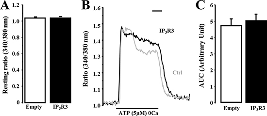 IP3R3 overexpression modifies ATP-induced Ca2+ transient profile into a sustained Ca2+ signal.