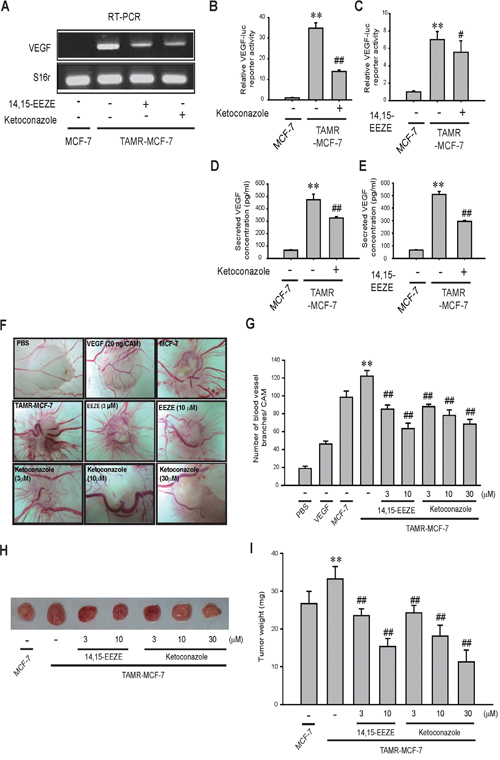 Effects of CYP3A4 inhibitor and EET antagonist on angiogenesis in TAMR-MCF-7 cells.