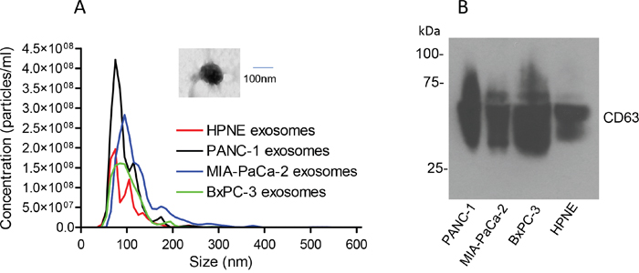 Characterization of exosomes isolated from pancreatic cancer cell lines.