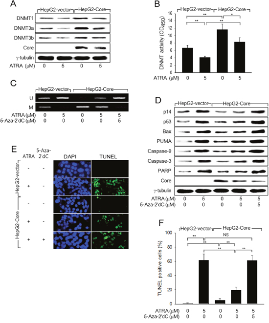 HCV Core represses p14 expression via promoter hypermethylation to overcome ATRA-induced apoptosis.