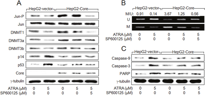 HCV Core activates DNMT1 expression in the presence of ATRA via activation of AP-1.