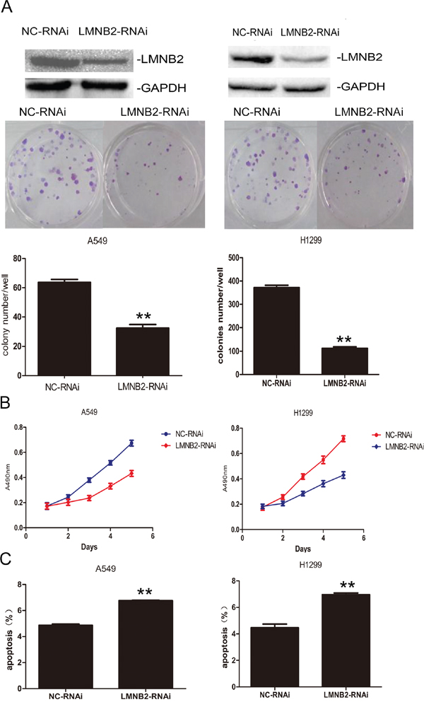 Knockdown Lamin B2 inhibits NSCLC proliferation.