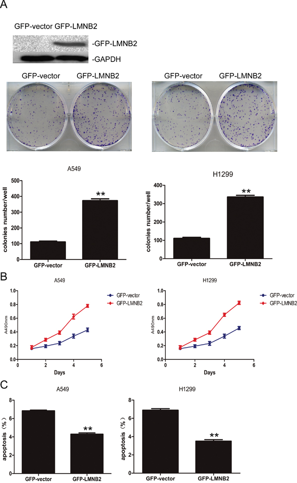 Overexpressed Lamin B2 promotes NSCLC proliferation.