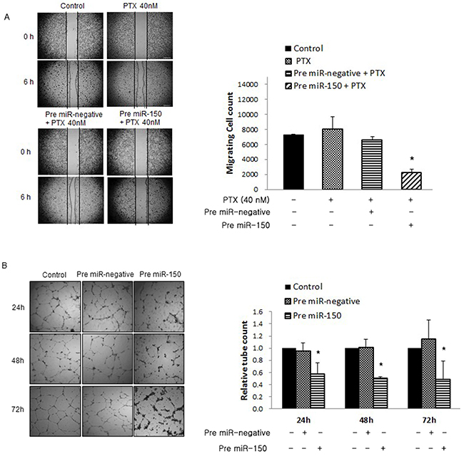 Effects of pre-miR-150 on cell migration and angiogenesis.