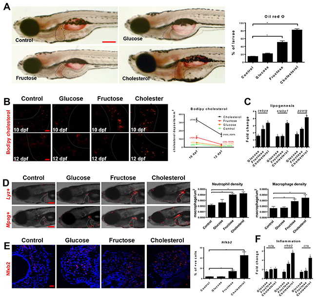 High fructose and cholesterol diets induced NASH in zebrafish larvae.
