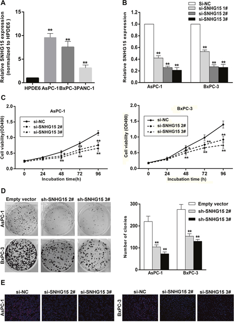 SNHG15 knockdown inhibits PC cell proliferation in vitro.