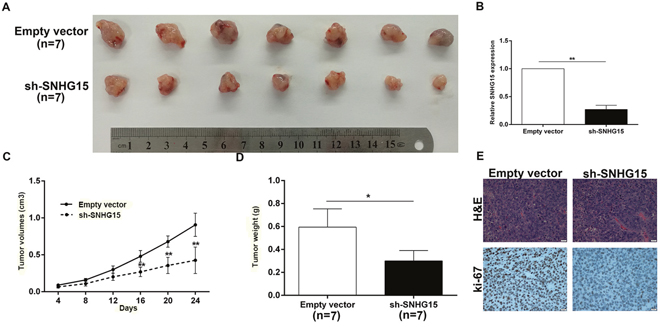 Knockdown of SNHG15 inhibits PC cell tumorigenesis in vivo.