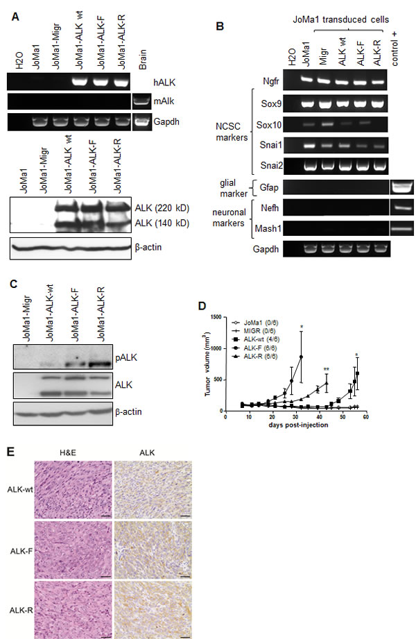 ALK-wt-, ALK-F1174L-, and ALK-R1275Q-expressing JoMa1 cells