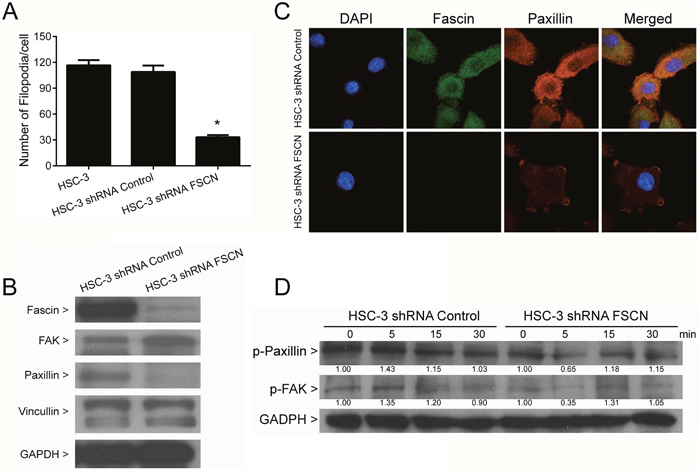 Inhibition of filopodia formation by fascin knockdown.