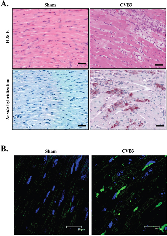 CVB3 infection causes accumulation of pre-amyloid oligomers in virus-infected mouse heart.