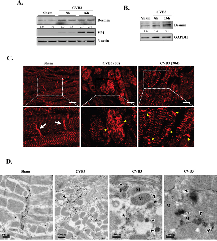 CVB3 infection leads to increased protein levels of desmin in vitro and results in the disruption of desmin structures in vivo.