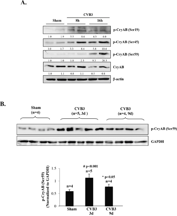 CVB3 infection results in phosphorylation of CryAB.