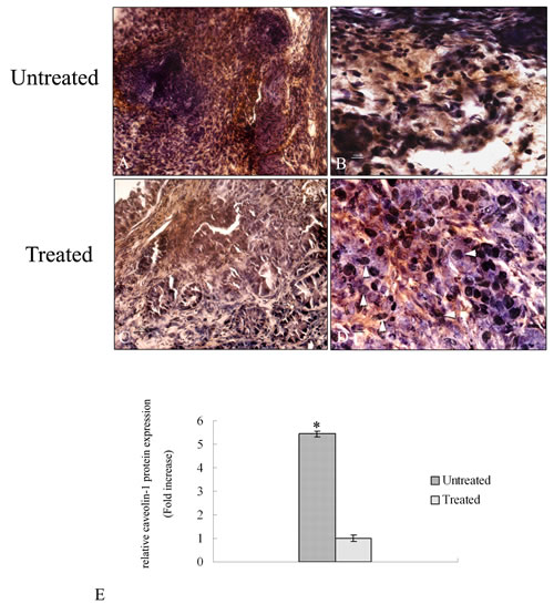 Immunohistochemical analysis of caveolin -1 protein in tumor sections.