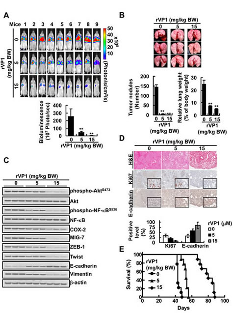 rVP1 decreases COX-2 and MIG-7 and suppresses lung cancer metastasis in xenograft mice.