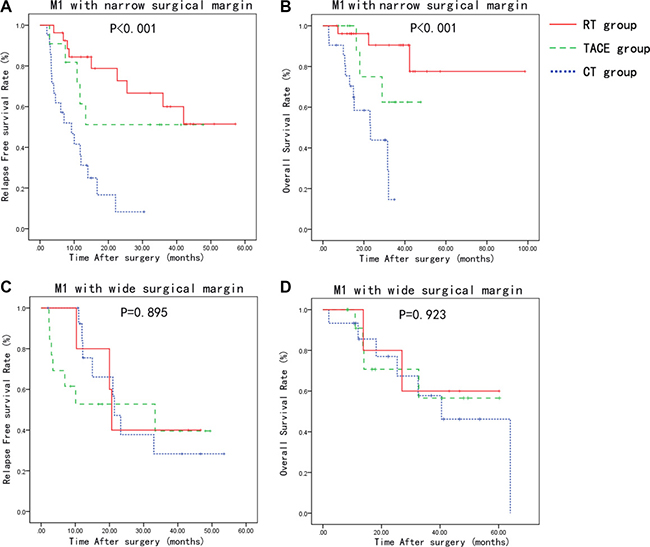 Relapse-free survival and overall survival curves of patients stratified based on the MVI type and surgical margin width.