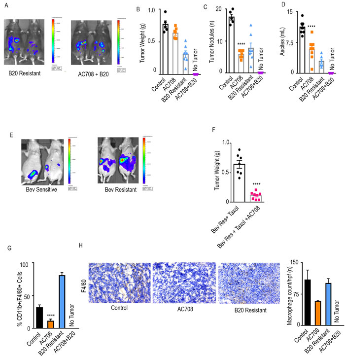 AC708 reduces tumor burden in setting of adaptive resistance to anti-VEGF therapy.