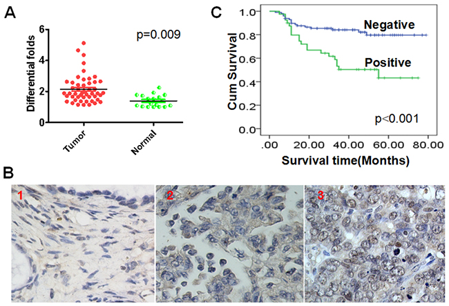 Elevated nuclear c-Myc expression is an unfavorable factor for ovarian cancer patients.