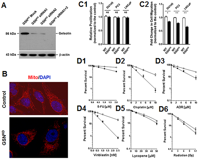 Gelsolin expression correlated with cell migration and resistance to anticancer drugs.