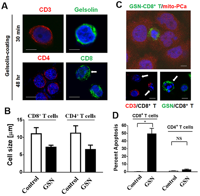 Secreted gelsolin desensitizes CD3-activated CD4&#x002B; T cells and induces the apoptosis of CD8&#x002B; T cells in the presence of PCa cells.