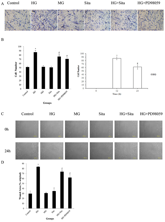 Sitagliptin inhibited HG-induced migration in cultured VSMCs.