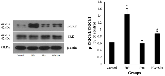 Sitagliptin inhibited ERK1/2 MAPK signal pathways under HG condition.