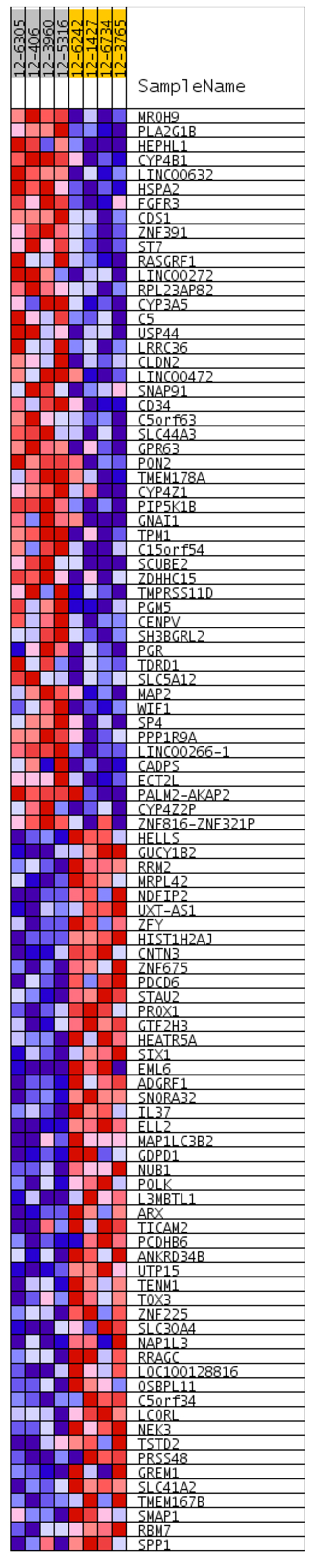 Heatmap shows top 50 differentially expressed genes between acinar and solid subtypes of lung AC.