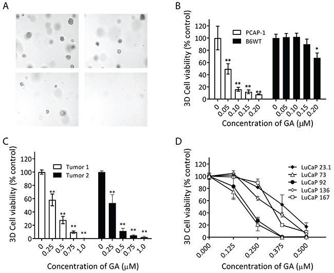 GA inhibited prostate cancer organoid growth.