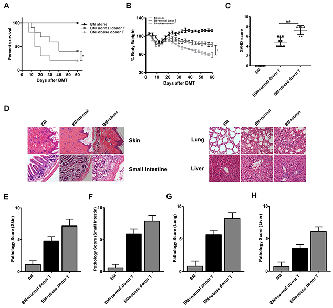 Obese donor splenocytes increases aGVHD&#x2013;induced lethality and target organs injury.