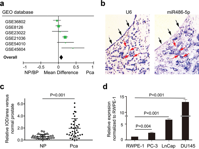 Up-regulation of miR-486-5p expression in prostate cancer patients and cell lines.