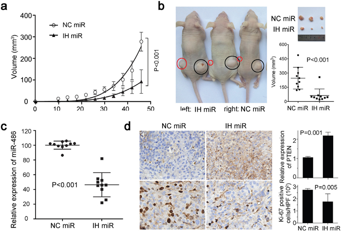 MiR-486-5p affects tumor growth in xenograft model.