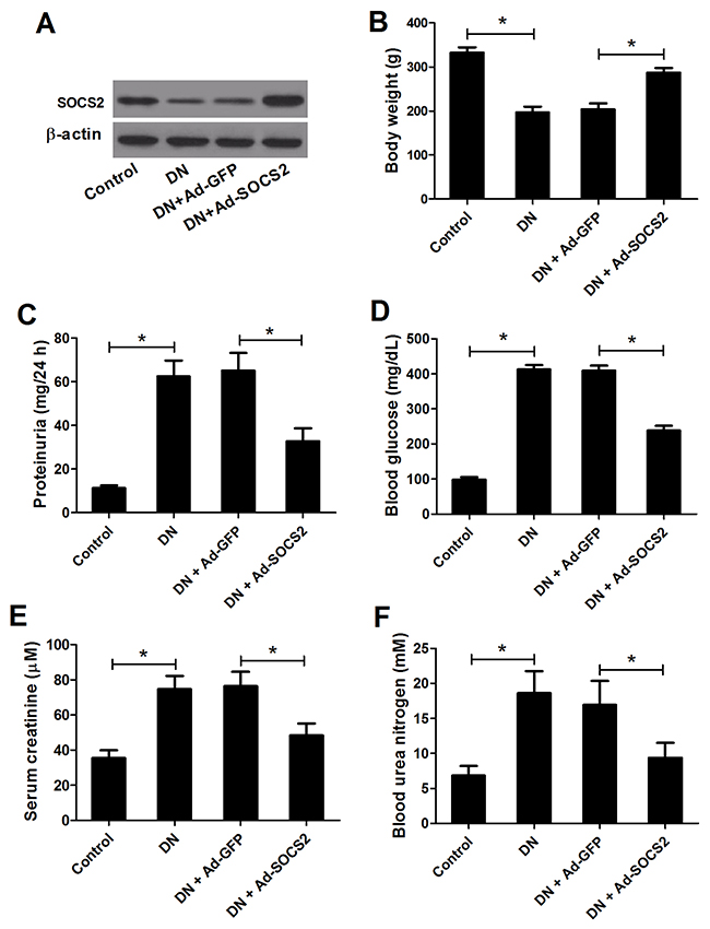 Effect of SOCS2 overexpression on diabetic renal injury.