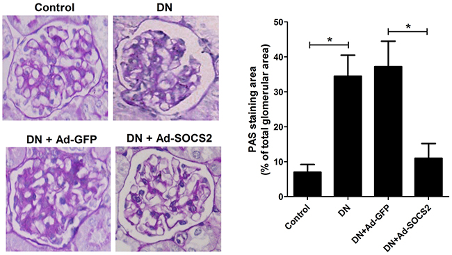 Effect of SOCS2 overexpression on renal injury of DN rats as assessed by PAS staining.