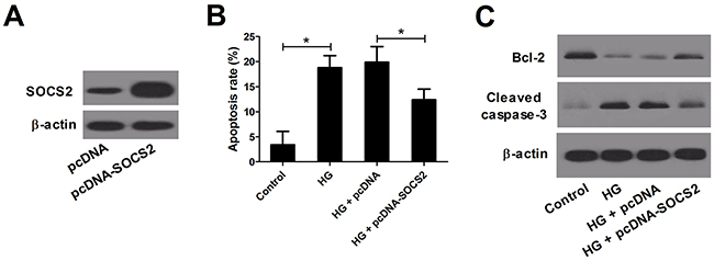 Effect of SOCS2 overexpression on apoptosis in HG-stimulated podocytes.