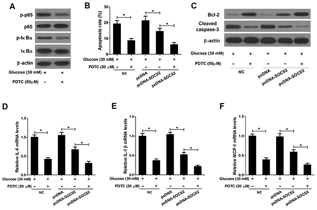 Effect of PDTC on apoptosis and inflammatory cytokines expressions in HG-stimulated podocytes transfected with pcDNA-SOCS2.