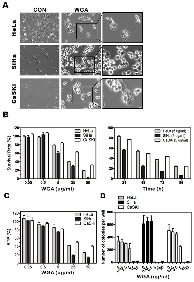 WGA induces formation of cytoplasmic vacuoles and paraptosis-like cell death in cervical carcinoma cells.