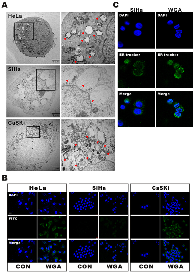 WGA induces both paraptosis and autophagy in HeLa and CaSKi cells, but only paraptosis in SiHa cells.