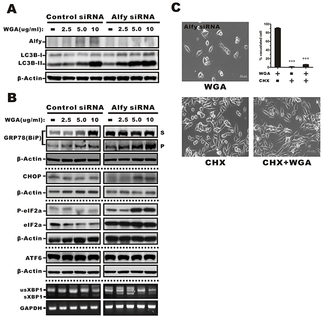 Effects of WGA on Alfy expression and the effects of Alfy knockdown ER stress-mediated cytoplasmic vacuolation and the UPR.