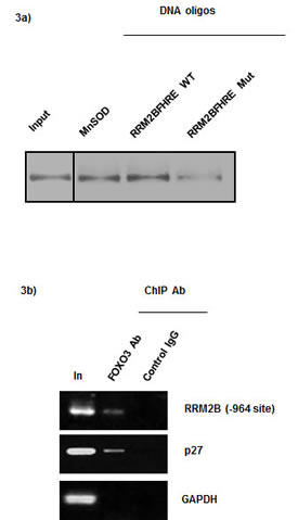 FOXO3 directly binds to the RRM2B promoter.