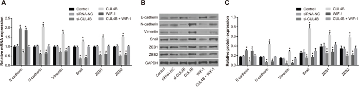 Effect of CUL4B on EMT in vitro.
