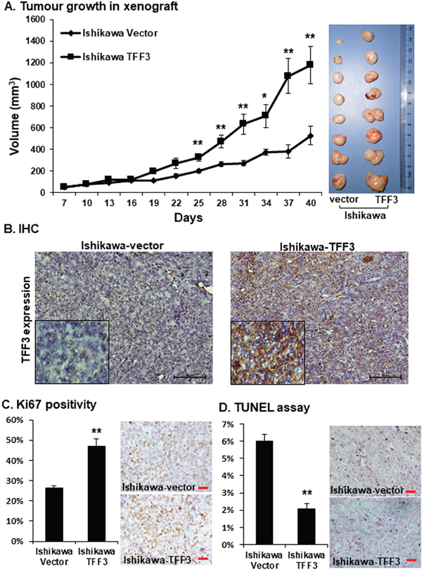 Forced expression of TFF3 in Ishikawa cell enhances tumour formation in immunodeficient mice.