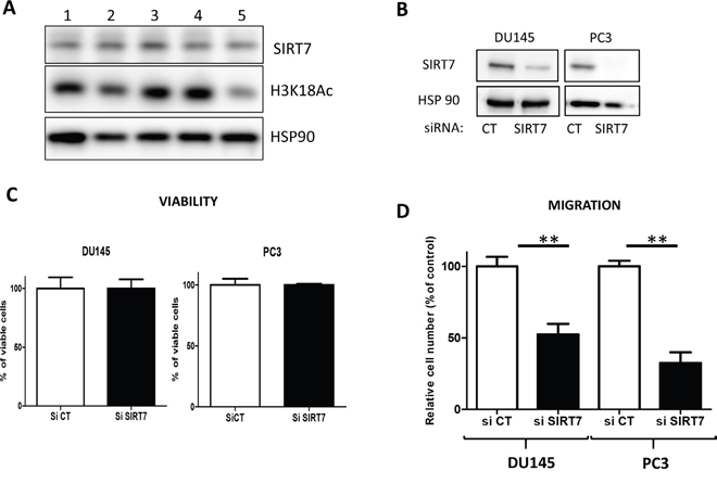 The knockdown of SIRT7 inhibits DU145 cell migration.