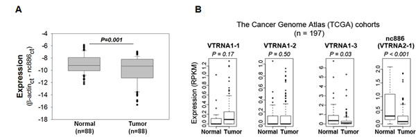 nc886 expression in clinical specimens from gastric cancer patients and TCGA cohorts.