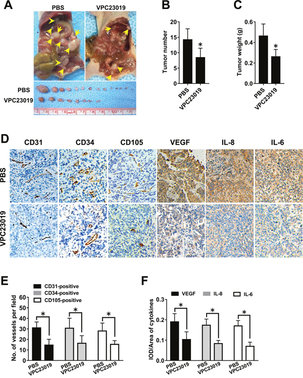 Effect of S1PR1/3 blockage on angiogenesis in vivo.