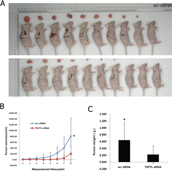Effects of TUFT1 knockdown on xenograf tumorigenicity in vivo in nude mice.