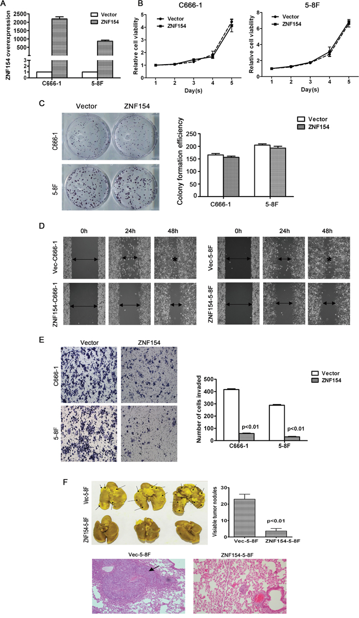 In vitro and in vivo analysis of the tumor suppressor function of ZNF154 in nasopharyngeal cancer (NPC).
