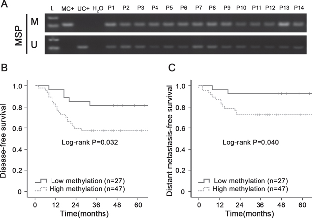 Hypermethylation of ZNF154 is associated with poorer survival outcomes in primary human nasopharyngeal carcinoma (NPC).