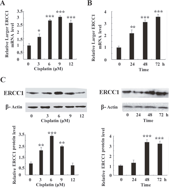 Cisplatin induces the expression of larger ERCC1 in ovarian cancer cells.