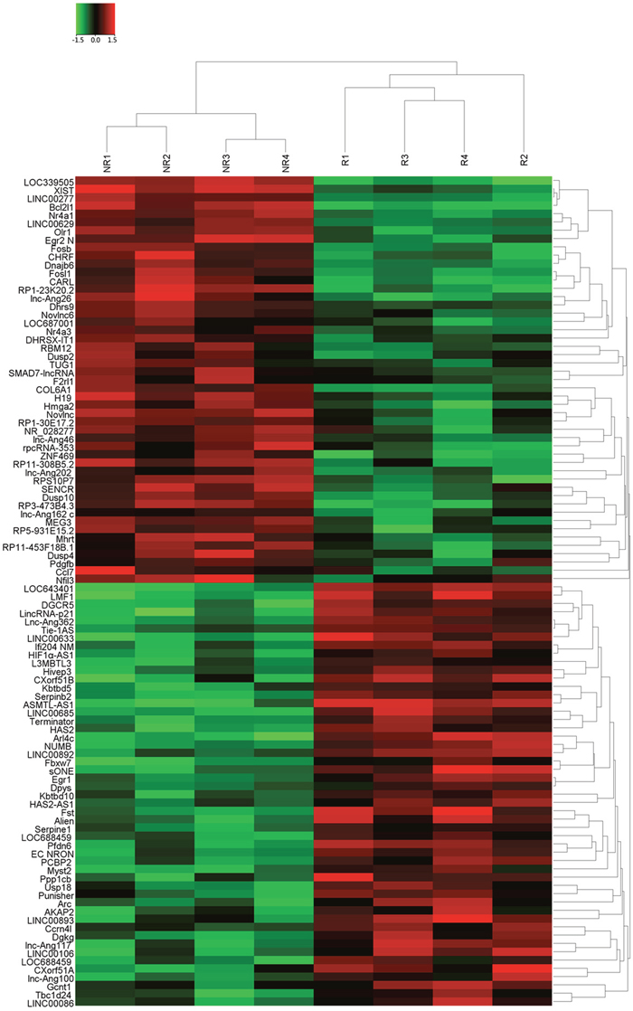 The heat map shows expression of the 100 lncRNAs most up- or down-regulated in CRC responding compared with non-responding patients to 5FU treatment.